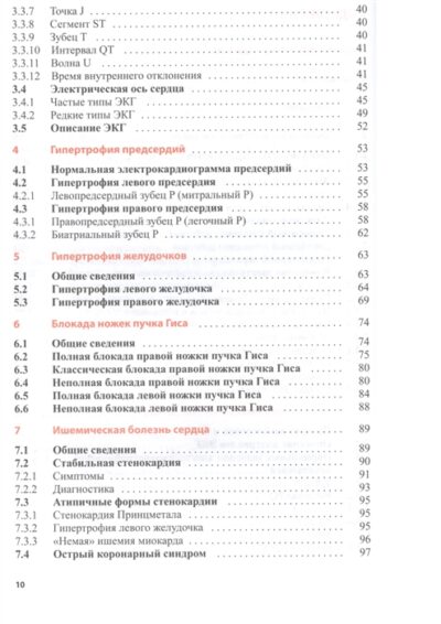 Клиническая интерпретация ЭКГ. Введение в электрокардиографию — изображение 5