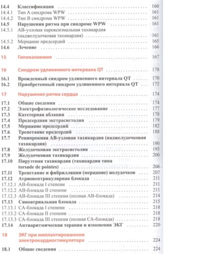Клиническая интерпретация ЭКГ. Введение в электрокардиографию — изображение 3