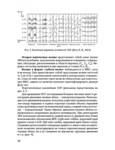 Клиническая сомнология детского возраста — изображение 4