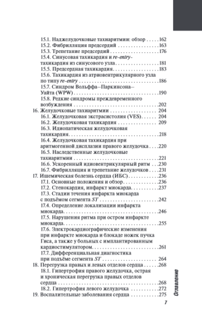 ЭКГ. Карманный справочник — изображение 4