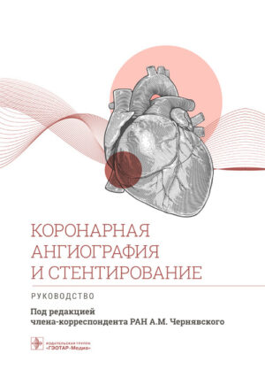 Коронарная ангиография и стентирование