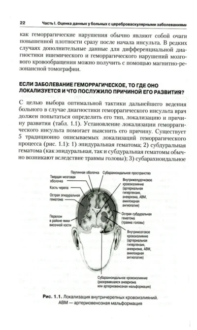 Инсульт. Клиническое руководство — изображение 4