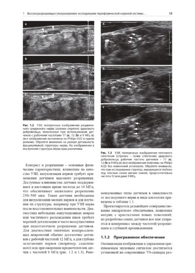 Ультразвуковой атлас периферической нервной системы. Анатомические и МРТ-корреляции — изображение 3
