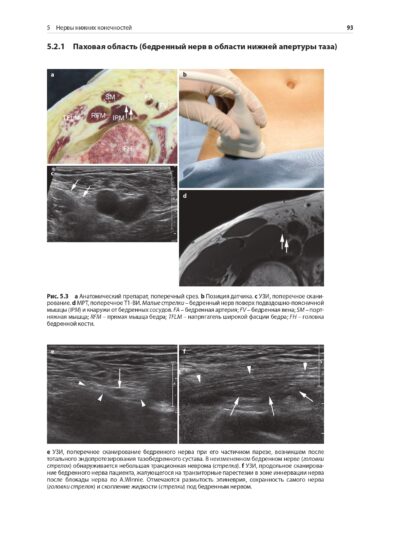 Ультразвуковой атлас периферической нервной системы. Анатомические и МРТ-корреляции — изображение 10