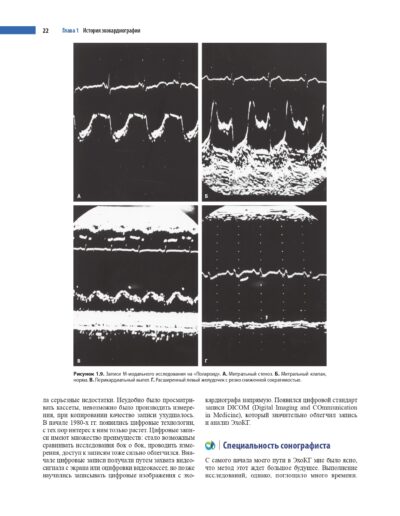 Эхокардиография по Харви Фейгенбауму — изображение 14