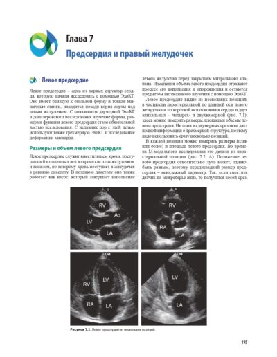 Эхокардиография по Харви Фейгенбауму — изображение 16