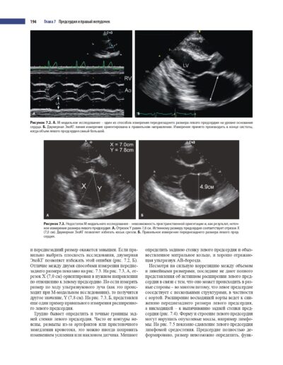 Эхокардиография по Харви Фейгенбауму — изображение 17