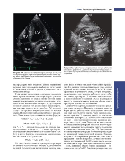 Эхокардиография по Харви Фейгенбауму — изображение 18