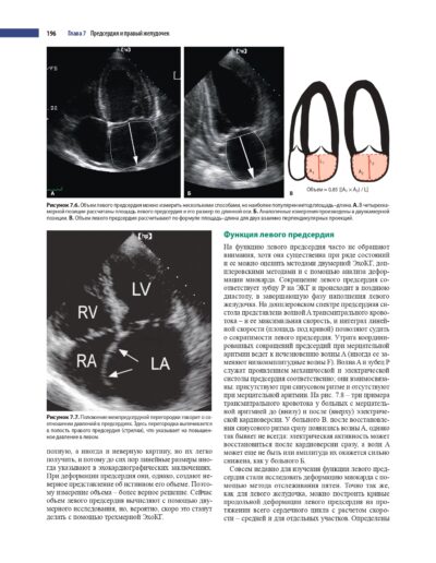 Эхокардиография по Харви Фейгенбауму — изображение 19