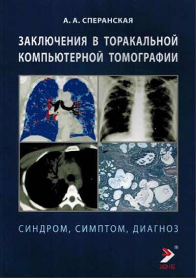 Заключение в торакальной компьютерной  томографии. Симптом, синдром, диагноз