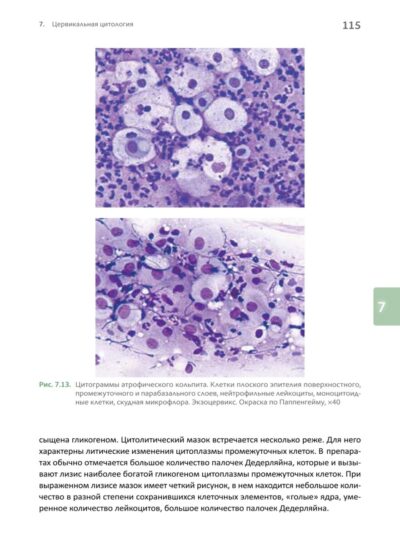 Основы клинической цитологии — изображение 11