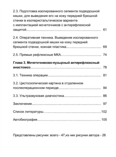 Мочеточниково-кишечный, пузырный антирефлюксный анастомоз в деривации мочи — изображение 3