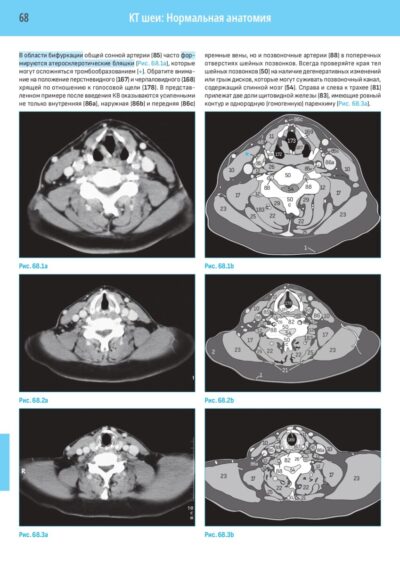 Компьютерная томография Базовое руководство (4-е издание) — изображение 6