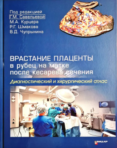 Врастание плаценты в рубец на матке после кесарева сечения. Диагностический и хирургический атлас