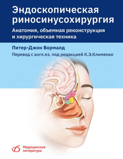 Эндоскопическая риносинусохирургия. Анатомия, объемная реконструкция и хирургическая техника