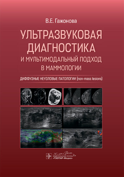 Ультразвуковая диагностика и мультимодальный подход в маммологии. Диффузные неузловые патологии (non-mass lesions)