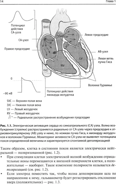 Быстрый анализ ЭКГ — изображение 2