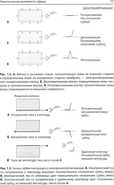 Быстрый анализ ЭКГ — изображение 6