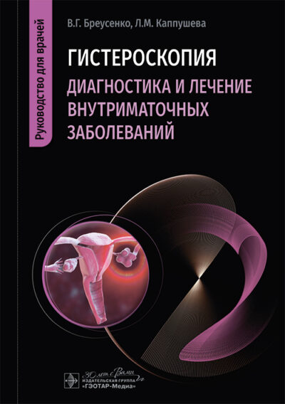 Гистероскопия. Диагностика и лечение внутриматочных заболеваний. Руководство для врачей