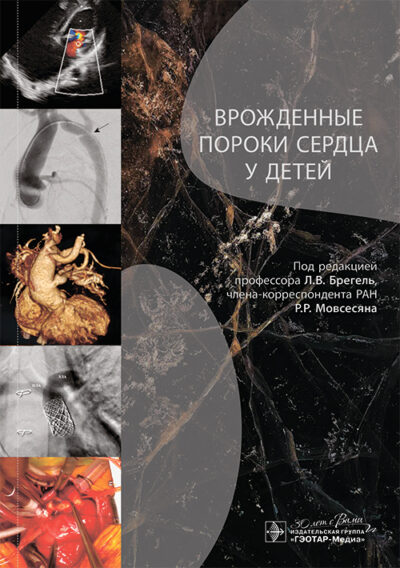 Врожденные пороки сердца у детей. Руководство для врачей