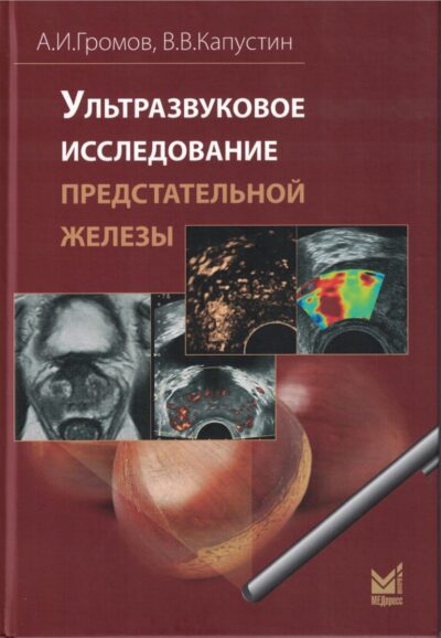 Ультразвуковое исследование предстательной железы