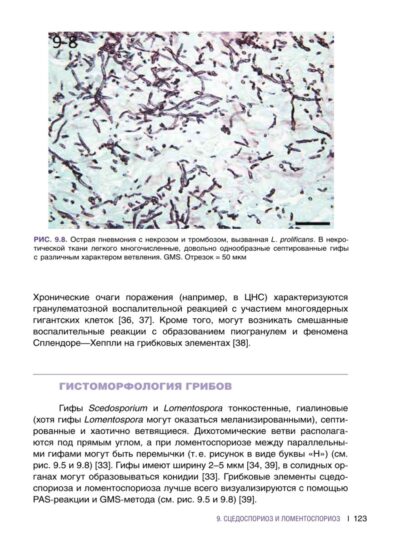 Гистологическая диагностика инвазивных микозов — изображение 12