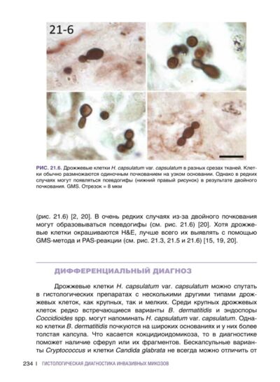 Гистологическая диагностика инвазивных микозов — изображение 7