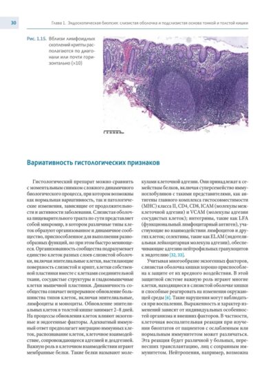 Колит. Интерпретация биопсий слизистой оболочки толстой и тонкой кишки. Диагностическое руководство — изображение 11