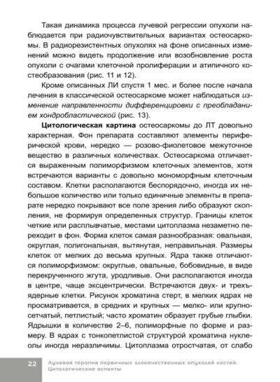 Лучевая терапия первичных злокачественных опухолей костей. Цитологические аспекты — изображение 8