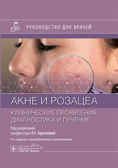 Акне и розацеа. Клинические проявления, диагностика и лечение. Руководство для врачей