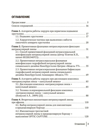 Склеральная фиксация интраокулярных линз от А до Я. Руководство для врачей — изображение 2