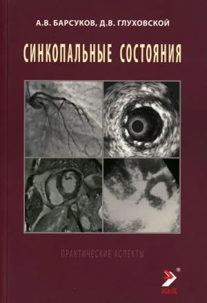 Синкопальные состояния: практические аспекты