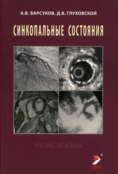 Синкопальные состояния: практические аспекты