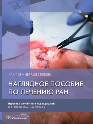 Наглядное пособие по лечению ран