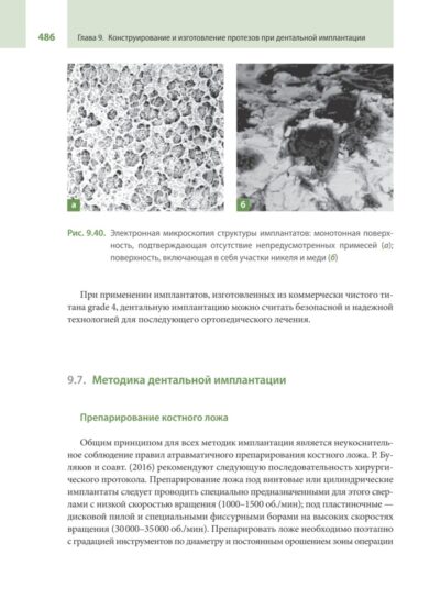 Протезирование при полной потере зубов (классические и инновационные технологии). Учебник — изображение 9