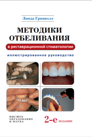 Методики отбеливания в реставрационной стоматологии