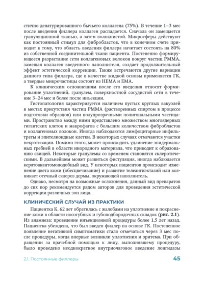 Постинъекционные осложнения в косметологии — изображение 3