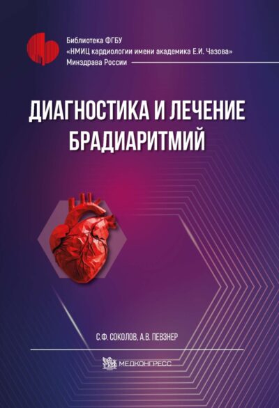 Диагностика и лечение брадиаритмий