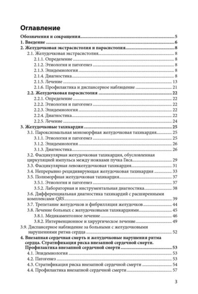 Современные подходы к диагностике и лечению желудочковых аритмий. Стратификация риска и профилактика внезапной сердечной смерти — изображение 3