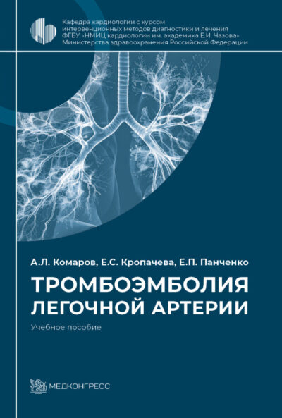 Тромбоэмболия легочной артерии