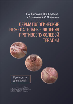 Дерматологические нежелательные явления противоопухолевой терапии. Руководство для врачей