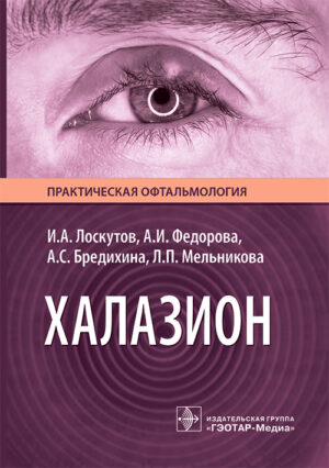 Халазион