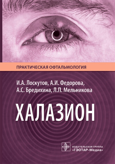 Халазион