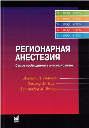 Регионарная анестезия