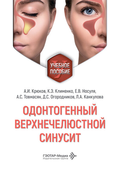 Одонтогенный верхнечелюстной синусит. Учебное пособие