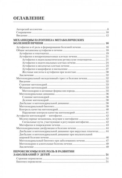 Метаболические болезни печени у детей и подростков — изображение 2