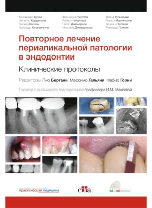 Повторное лечение периапикальной патологии в эндодонтии. Клинические протоколы