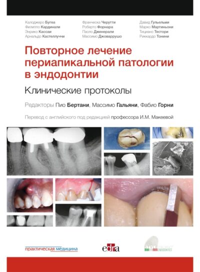 Повторное лечение периапикальной патологии в эндодонтии. Клинические протоколы