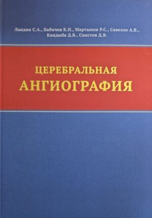 Церебральная ангиография