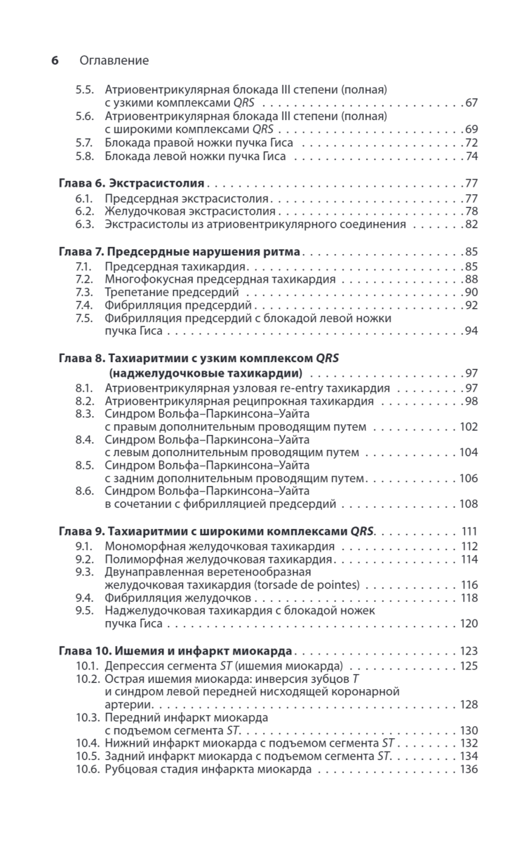 Карманный справочник по ЭКГ — изображение 3